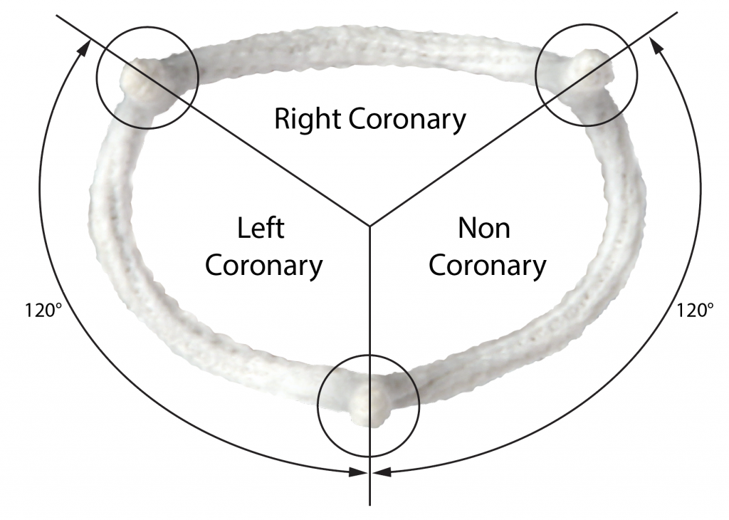 HAART 300 Aortic Annuloplasty Device 