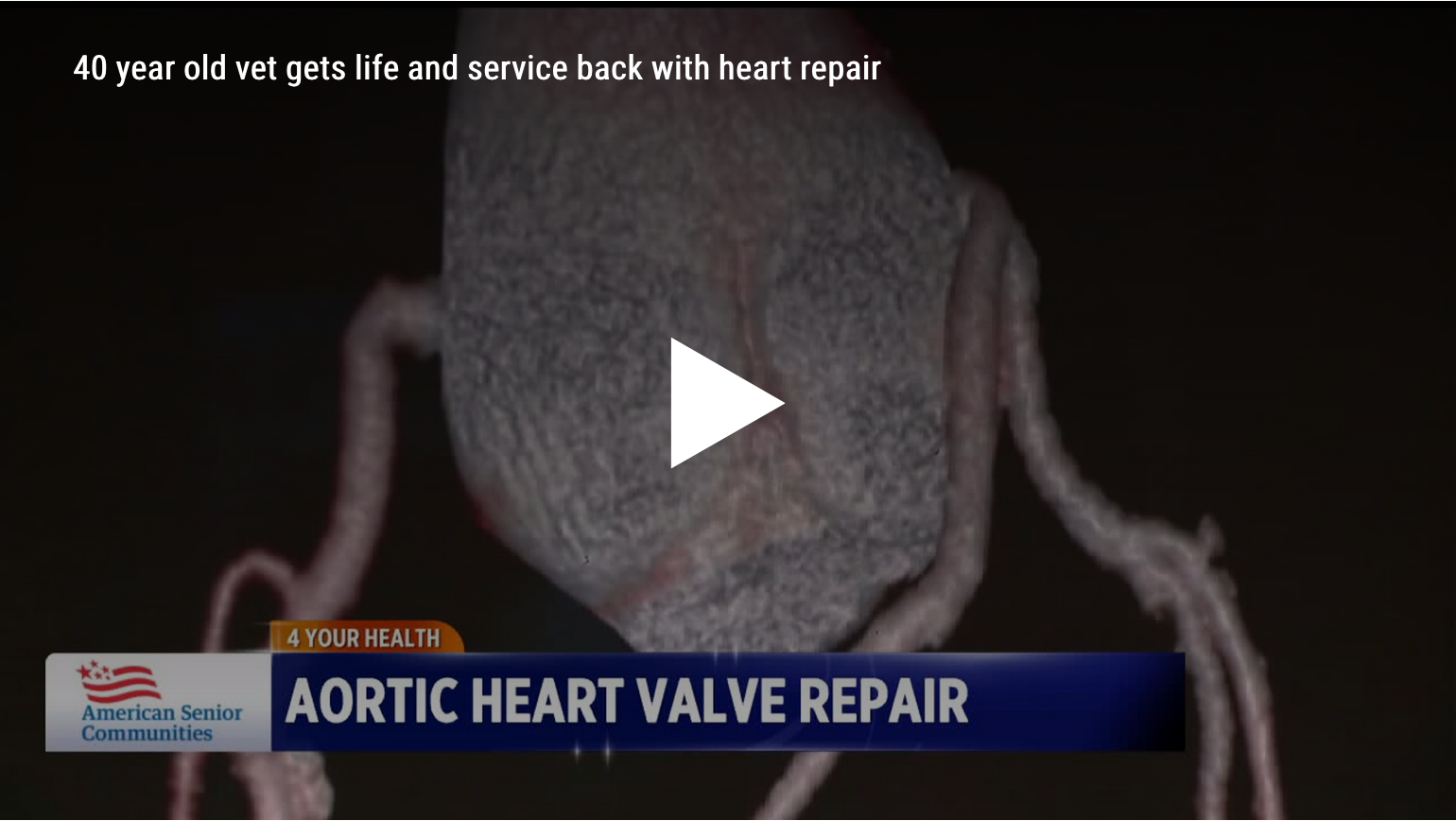 Article from WTTV-TV about 40-year-old Vet get life and service back with heart repair using the HAART 300